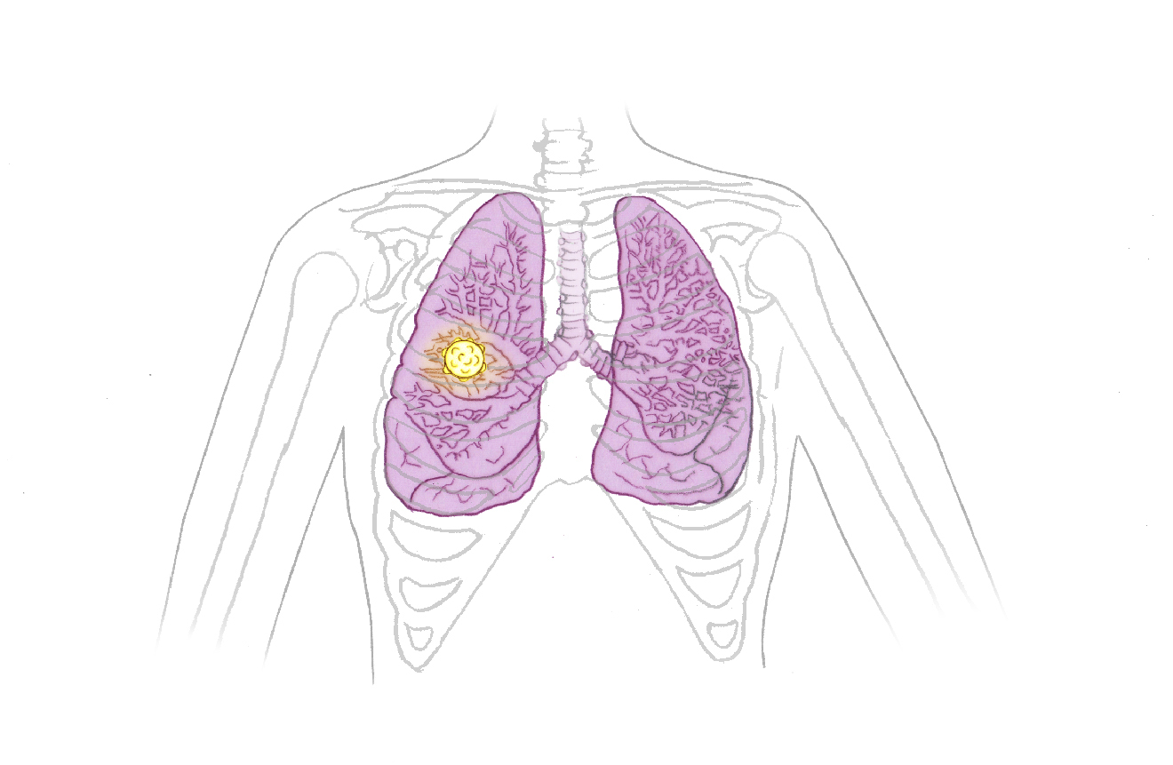 Illustrations for website GERMAN 01